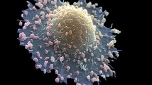 خلية سرطانية