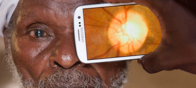 طبيق للهواتف الذكية لتشخيص أمراض العين‎