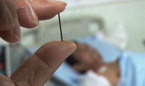 ابرة 