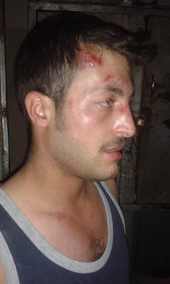 تعرض للضرب من ضابط سوري قام بالدوس عليه بالبوط