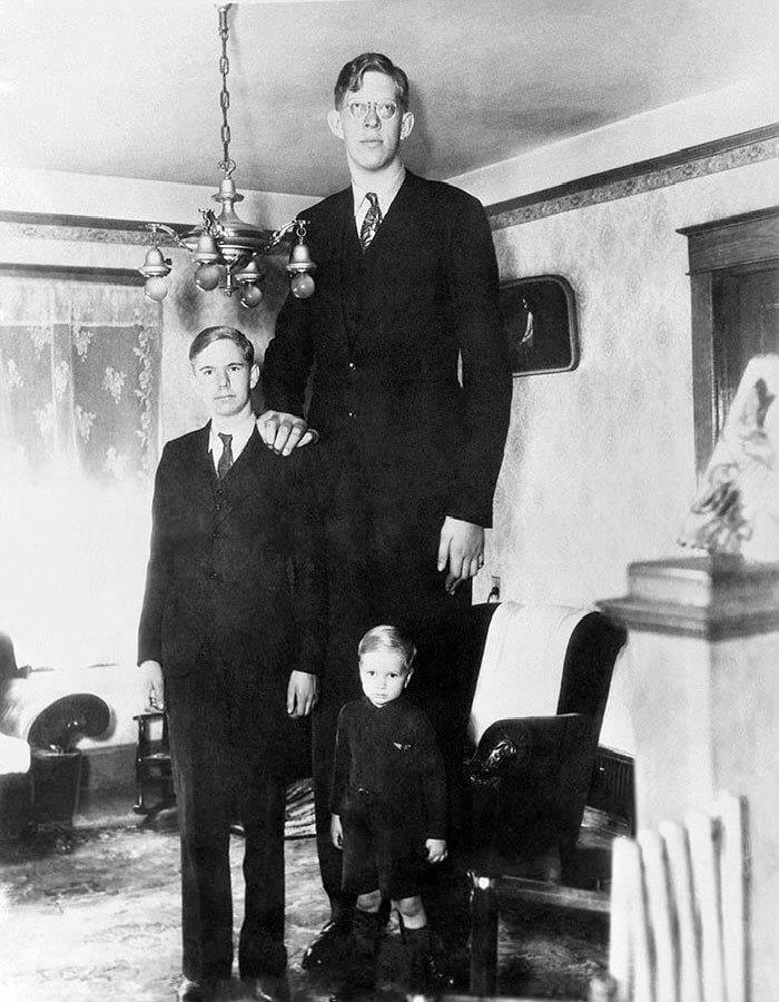 «روبيرت والدو» أطول رجل في التاريخ وأشقاؤه