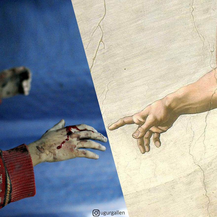 صورة للفنان التركي "أوغور جالن"، تبين يد لطفل والدماء تسيل على يديه، بينما طفل آخر يده بحالة جيدة.