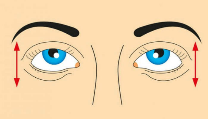 يجب ممارسة تمرين حركة العين وانت في وضع مستقيم سواء جالس أم واقف، حرِك عينيك صعودا ونزولاً 5 مرات وركز في كل اتجاه، كرر هذه العملية 3 مرات يوميا.