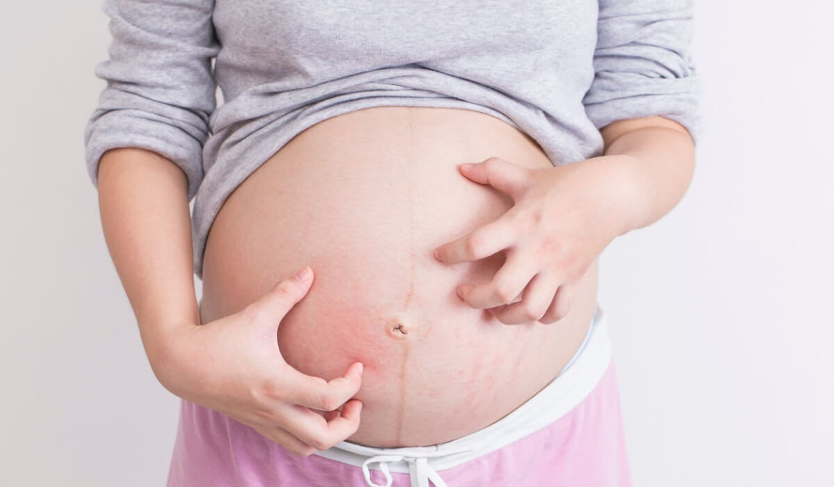 زيت اللوز هو علاج منزلي فعّال لتشققات البطن خلال الحمل