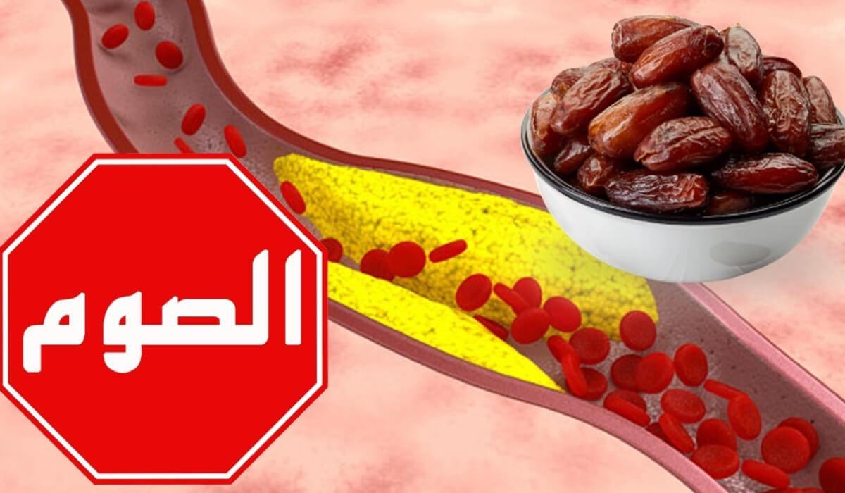 صوم مريض الكوليسترول في رمضان
