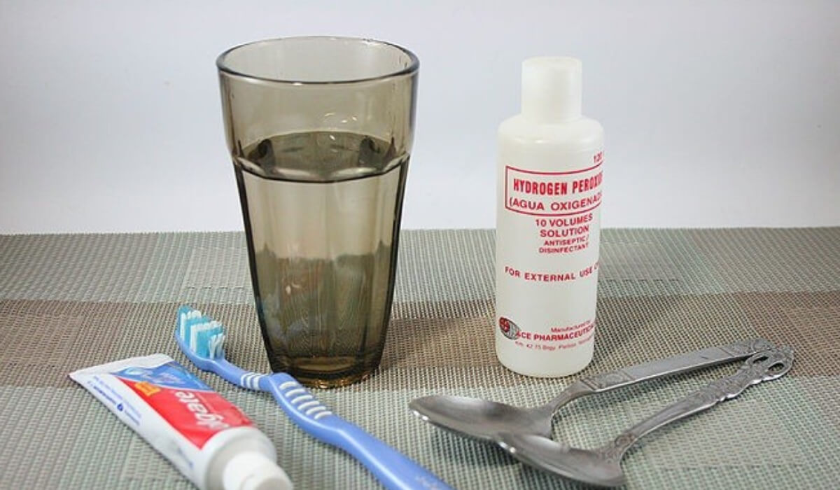 تبييض الأسنان ببيروكسيد الهيدروجين